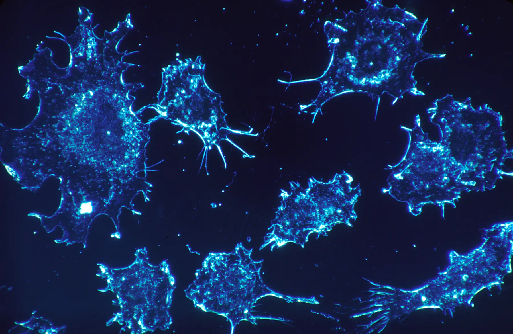 Cancer cells in culture illuminated using darkfield amplified contrast